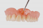 Contouring the denture for natural-looking gum areas.