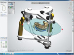 Figure 4. Occlusion and excursive movements are checked on an articulator. Interferences can be cleared with an auto-adjust feature or manually to give the technician full control of the final outcome.