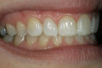 Figure 4a  The final results of conservative treatment.