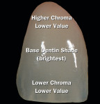 Figure 4  Image of the same natural tooth, which shows the natural color contrasts that exist within the tooth.