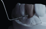 Fig 3. The author fabricated an alveolar model and measured the facial space with a periodontal probe.