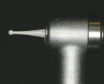 Figure 5  Final removal of caries-infected dentin was achieved using a No. 6 K1SM bur at 1,250 rpm.