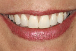 Figure 12  Posttreatment smile view.