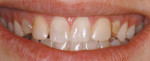 Figure 3 Smile view of the patient at presentation.