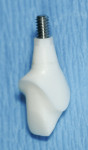 Figure 12 Custom zirconia abutment for a cementable crown.