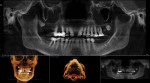 Fig 7. Initial radiographs showing dental condition and bone levels.