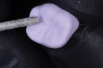 The flat-ended parallel medium-grit diamond
bur is extremely effective for sprue removal, interproximal adjustments, contouring, and enhancing or adding anatomy.