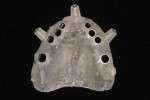 Fig 6. Fully edentulous surgical guide produced using stereolithography.