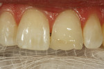 Figure 8  The highly chromatic artificial dentindisplayed primary optical properties.