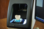 Fig 1 and Fig 2. A Pala DIgital Denture cases
is scanned in at Lauterbach Dental Lab.