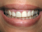 Figure 1  Pretreatment smile view.