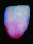 Fig 14. A warm enamel layer was applied to the gingival and completed by alternating different colors of enamel such as T1 and T2.