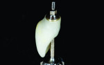 Fig 12. The base had a 1-mm collar and a specific surface for soft-tissue stability.