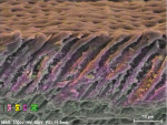Fig 14. SEM image of a dentin cross-section treated with a single oxalate strip and subsequently subjected to a composite challenge (dissolution/mechanical brushing/periodic pH cycling) for 30 days. Oxalate crystals are still clearly visible.