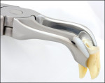 Figure 2  The Schumacher #79AS combines features of both a cowhorn, which engages the furcation, and standard forceps which engage the crown of the molar.