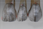 Fig 4 and Fig 5. As the contact areas move from the centrals to the canines, they move cervically, as represented by the red line.