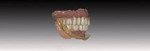 Fig 5. The digital tooth arrangement is established.