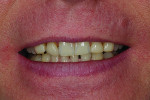 Fig 2. Smile prior to treatment.