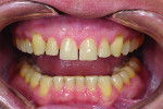 Fig 9. After orthodontic treatment.