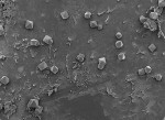 Figure 2  This SEM shows that the Perio Tray<sup>®</sup> maintained a sufficient concentration of a tetracycline for crystallization at the bottom of the pocket. Images used with permission. ©2007 Perio Protect, LLC.