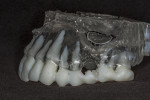Fig 6. Completed lateral sinus window on the STL model.