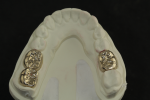 Fig 2. Milled gold crowns from Strategy Milling.
