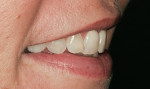 Figure 2  Right side before treatment.