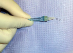 Figure 1  The resized wand with the needle bent at a 10° to 15° angle to the bevel, ready for a mandibular PDL injection.
