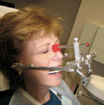 Figure 6  After taking preliminary impressions and bite registrations, a facebow registration was taken. An Artex facebow was used to achieve a wax-up and final restorations that were positioned properly relative to her exact cranium/axis relationshi