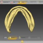 Fig 5. After scanning, the impressions are converted to an STL file ready for digital denture design.