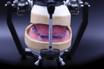 Fig 7. With conventional workflow, the occlusal rim records and master casts are mounted on a dental articulator for designing maxillary and mandibular tooth arrangement and occlusal scheme.