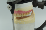 Fig 8. With a conventional workflow, you can visualize the interresidual or prosthetic space from the facial, buccal, posterior or lingual, and occlusal views. The digital workflow allows visualization in perspectives that we could never see before. We can now look through the superior or inferior of articulator and model base to see the relationship of ridge, intaglio, and occlusion.