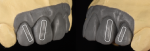 Fig 2. Light reflection shows the optical view of how we see teeth. These optical reflections are areas where the substructure design needs convexity to aid in the light reflection.