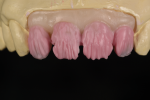 Fig 7. Based on the substructure design and liner materials, the dentin layer is simplified.