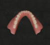 Figure 1  Compare and Contrast, Pre-extraction dentate state.