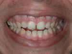 Fig 2. Close-up view of patient’s smile.