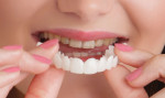 Zirlux Acetal LTD is exclusively approved for Snap-On-Smile®, a fully removable full or partial arch that covers the patient's existing dentition.