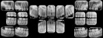 Figure 19  Full-mouth series radiographs.