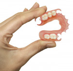 Figure 1  THE SUNFLEX SOLUTION (1. and 2.) A Sunflex bilateral partial denture.
