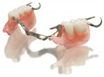 Figure 2  THE SUNFLEX SOLUTION (1. and 2.) A Sunflex bilateral partial denture.