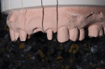 Figure 1  An ideal mounted master model. Note the clean detail in the mucobuccal fold.