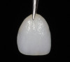 Figure  13   A tooth from an extra denture set that fits the space can be molded into position by using red rope wax.