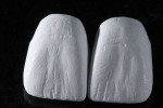 Fig 14. The six full-contour crowns are milled with subtle surface texture for the addition of shading liquids prior to staining and sintering.