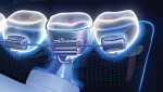 Fig 4 and Fig 5. Targeted Clean brush head pinpoints the bristles in and around orthodontic brackets (Fig 4), behind arch wires (Fig 5), and around molar bands to remove biofilm and food debris.