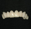 Figure 12  Adhesive applied to tooth