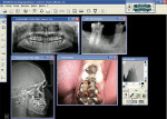 Figure 1  With Kodak Dental imaging software, every photograph or radiograph for a particular tooth, teeth, or arch can be viewed.