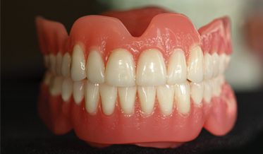 The Evolution of Digital Dentures