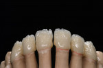 Figure 49: This image makes the generic structure of the fired porcelain clear. The so-called 