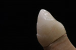 Figure 57  After the third firing, the work carried out was in a subtractive manner. From the lateral view of the canine tooth, the three horizontal curved surfaces on the vestibular surface are visible.