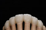 Figure 65   A virgin tooth was created as a basis and then adjusted correspondingly to the abrasion associated with aging.